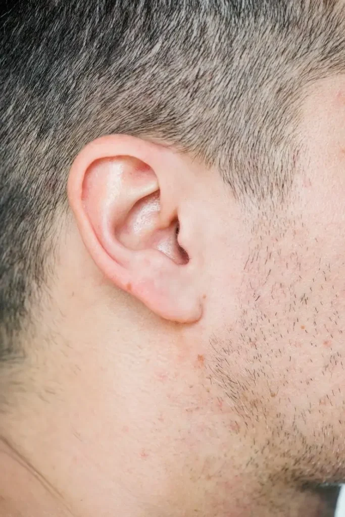 Professional Ear Wax Removal